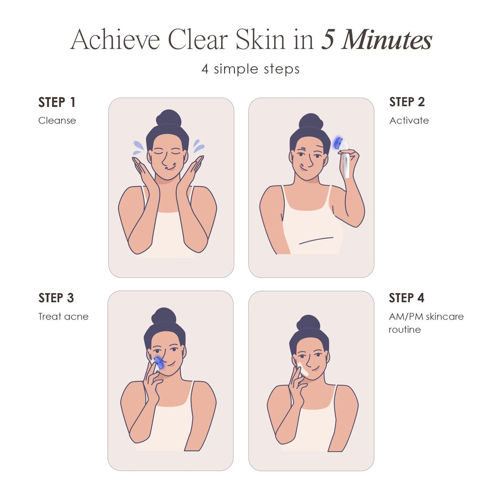Blue Light Therapy for Acne |Facial Light Therapy Devices for Acne | Anti-Acne Skincare | Reduce Dark Spots & Scars |Remove Blemishes