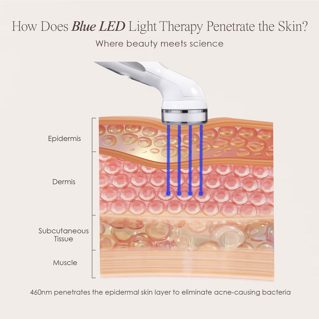 Blue Light Therapy for Acne |Facial Light Therapy Devices for Acne | Anti-Acne Skincare | Reduce Dark Spots & Scars |Remove Blemishes