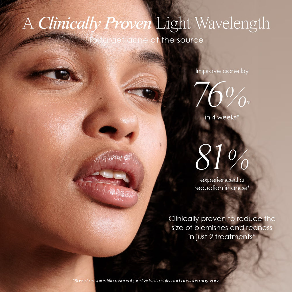 Blue Light Therapy for Acne |Facial Light Therapy Devices for Acne | Anti-Acne Skincare | Reduce Dark Spots & Scars |Remove Blemishes